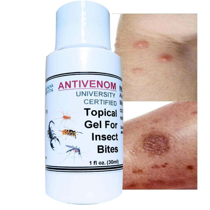 Insect Bites Anti-Venom Silica Topical Gel Natural Remedy