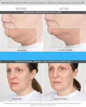 Facial Rejuvenation Massage Cupping Set for Face, Eyes, Neck