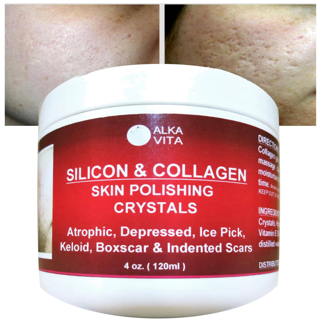 Acne Skin Scars SILICON & COLLAGEN Polishing Crystals Gel