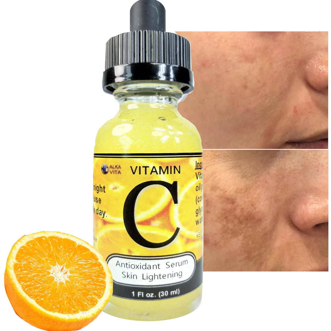 Skin Lightening Vitamin C Serum